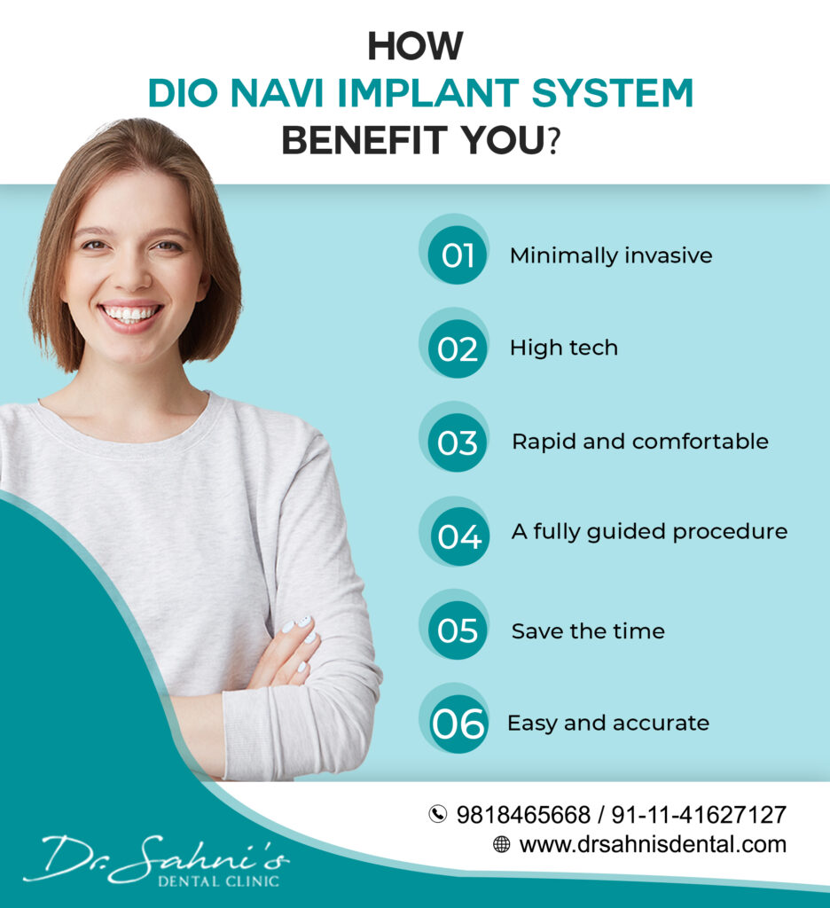 Benefits of Dio Navi Implants