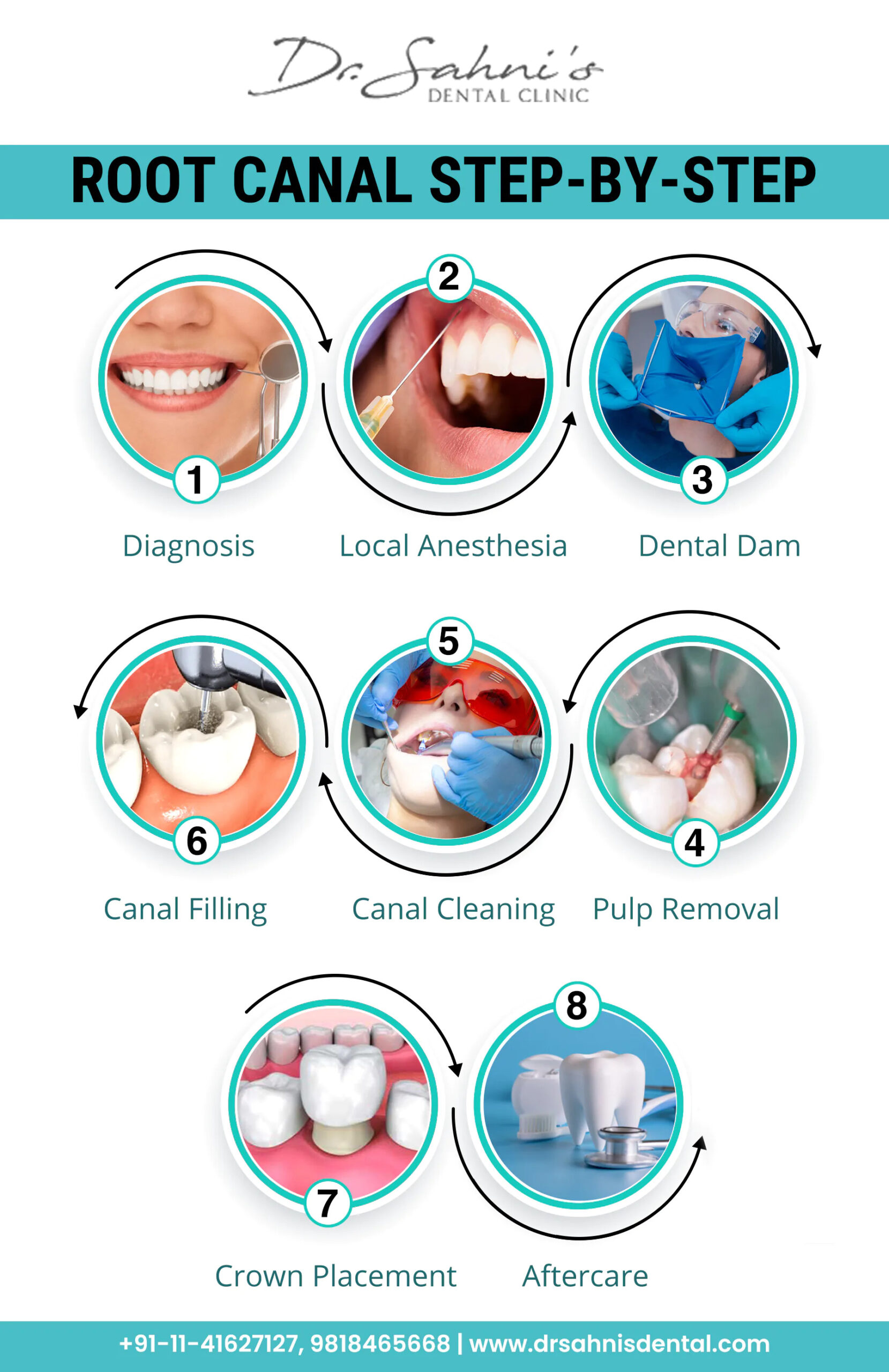 Myths and Facts about Root Canal Treatment Dr Sahni's Dental Clinic