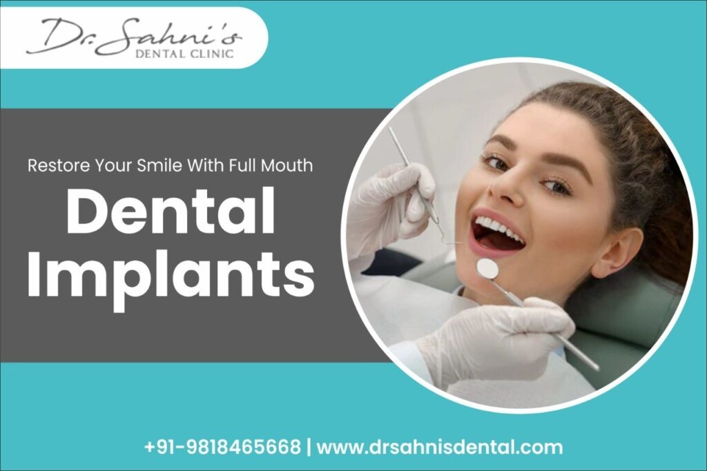 Full mouth dental implants Procedure, Cost