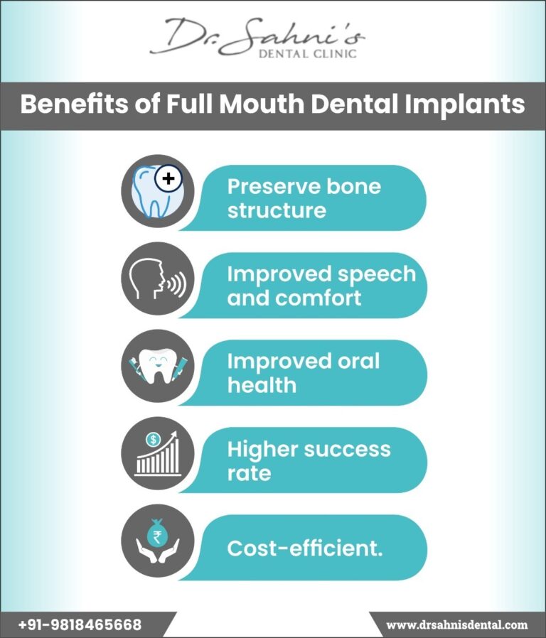 Full mouth dental implants Procedure Cost