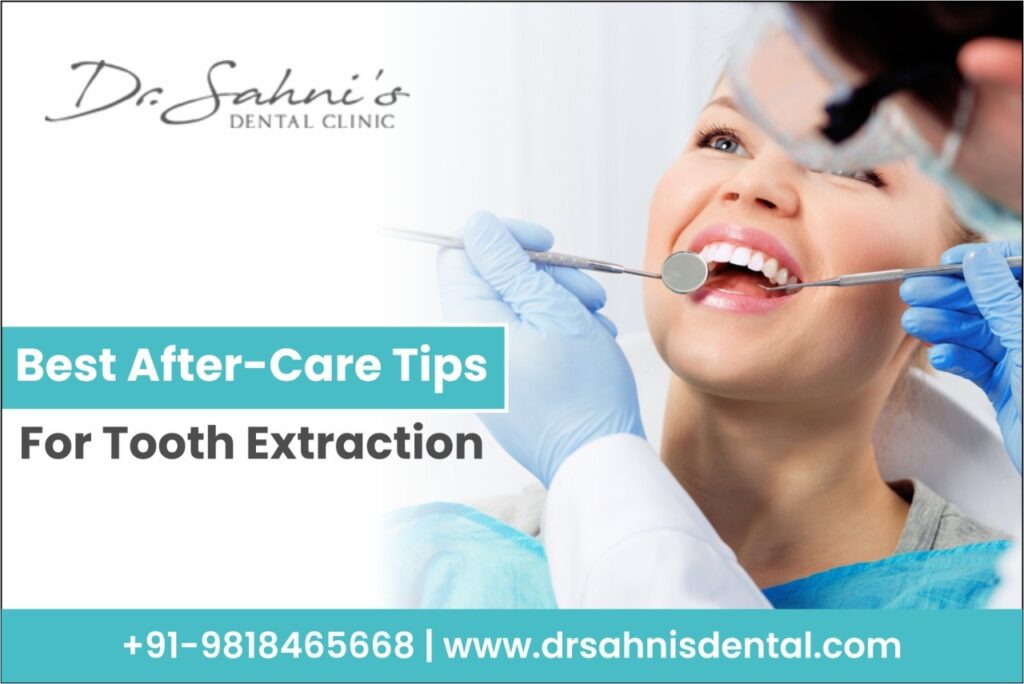 Best aftercare tips for tooth extraction