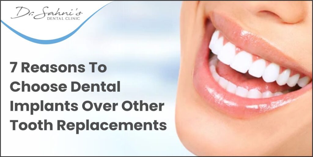 7 Reasons to Choose Dental Implants Over Other tooth Replacements