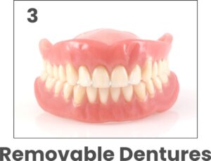 Removable Dentures