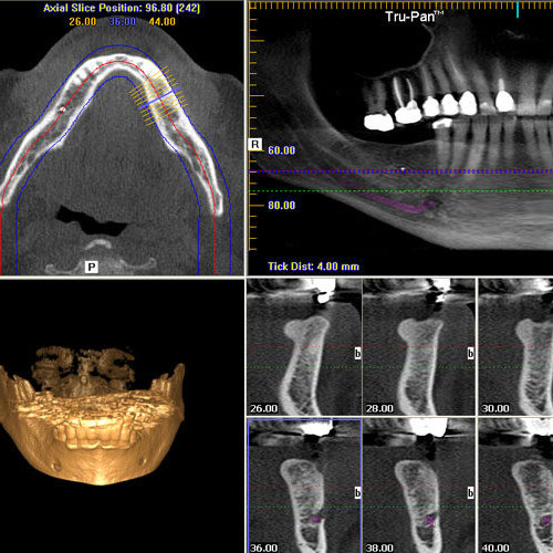 CBCT - Cone Beam Computed Tomography