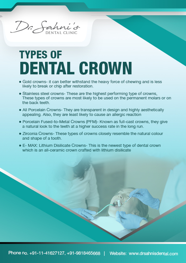 dental-crown-in-south-delhi