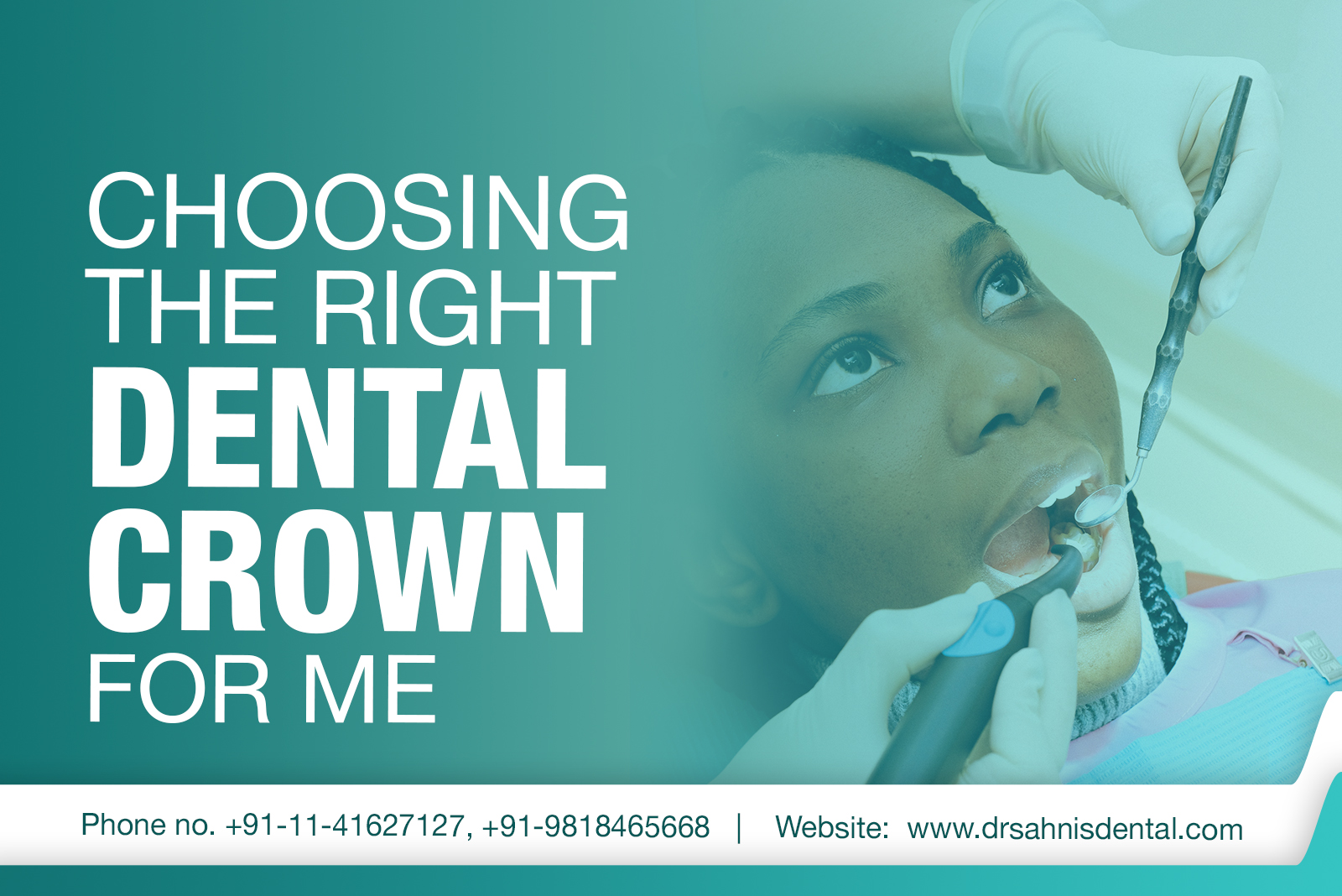 Dental-crown-in-south-delhi