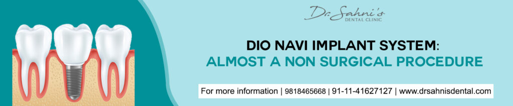 Dio Navi Implant System