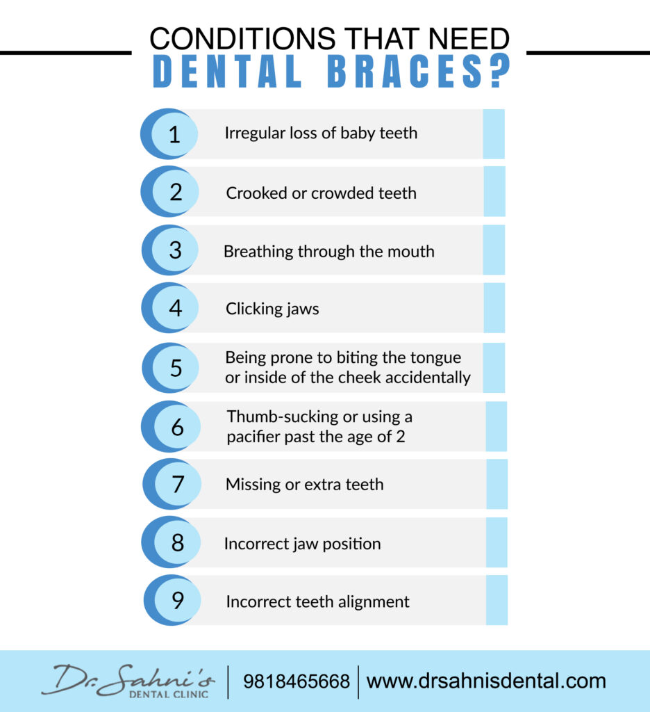 Conditions For Dental Braces