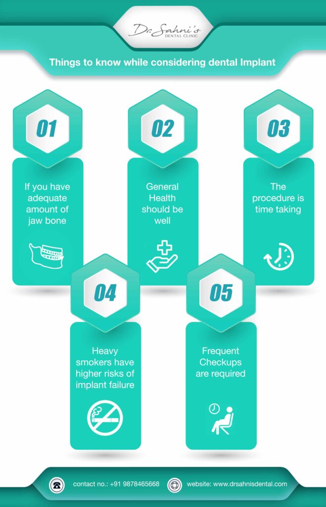 Things to know for dental implant