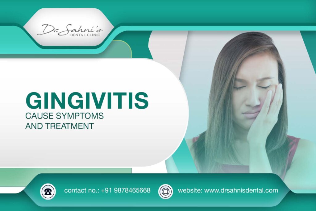 Cause, Symptoms and Treatment of Gingivitis