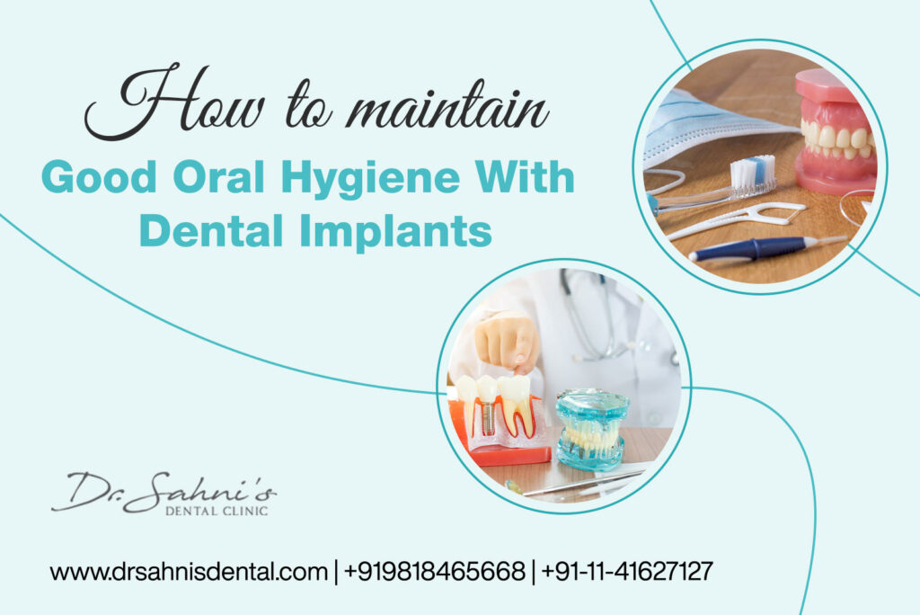 Oral Hygiene With Dental Implants