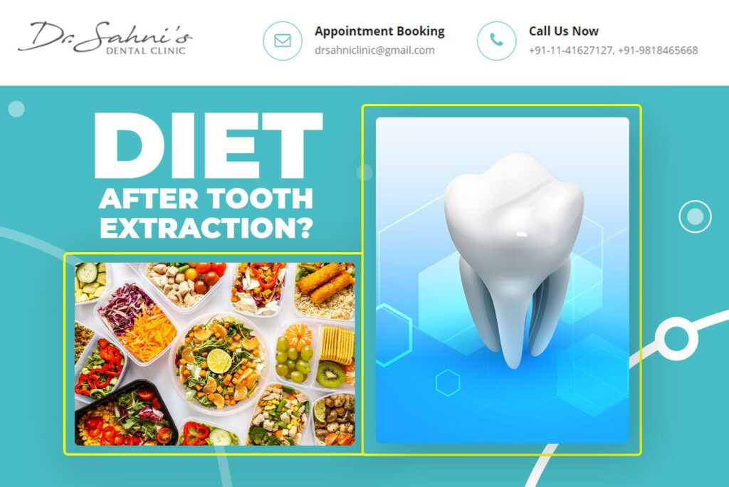 diet after tooth extraction
