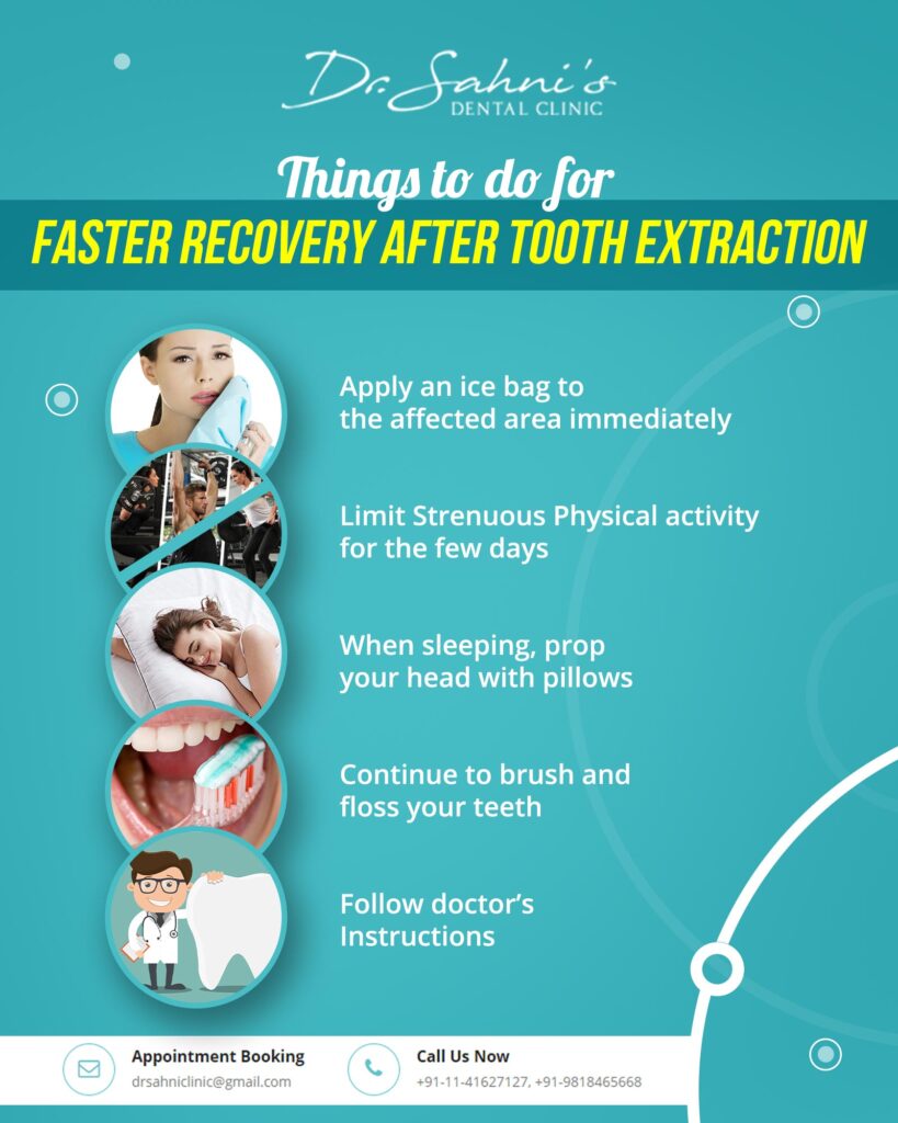 things to do after tooth extraction