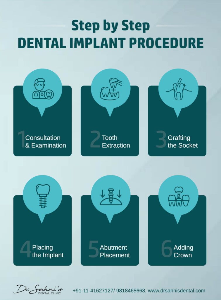 dental implant procedure