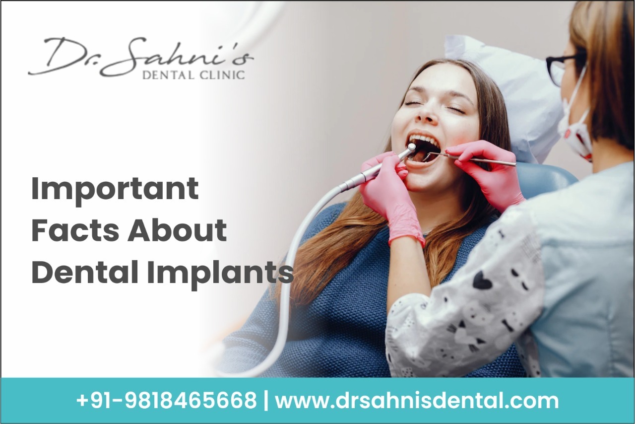 Important Facts About Dental Implants