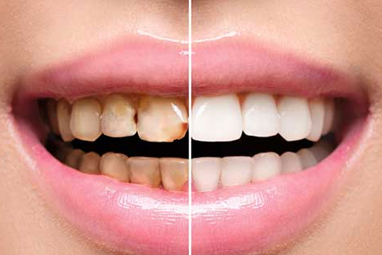 Dental Clinic in South Delhi, Dentist in South Delhi